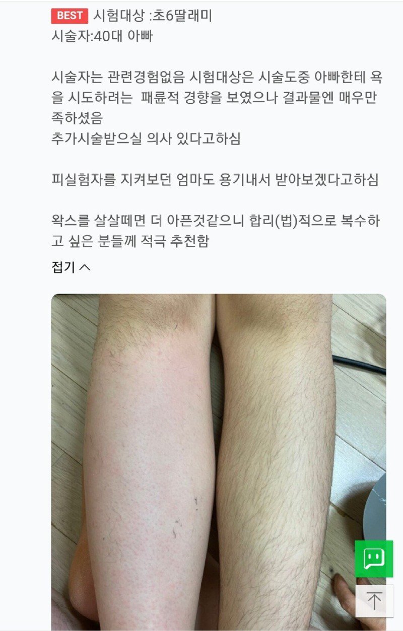 초6 딸내미 왁싱해준 40대 아빠.jpg